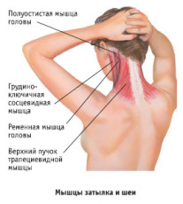 мышцы шеи